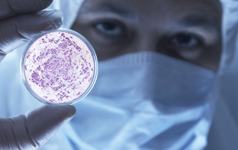 Medicina: super bakterija novi ubica