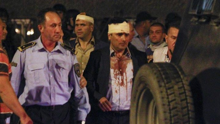 Reagovanje Zorana Zaeva: Kao napadnuti čovek osuđujem svako nasilje protiv institucija sistema